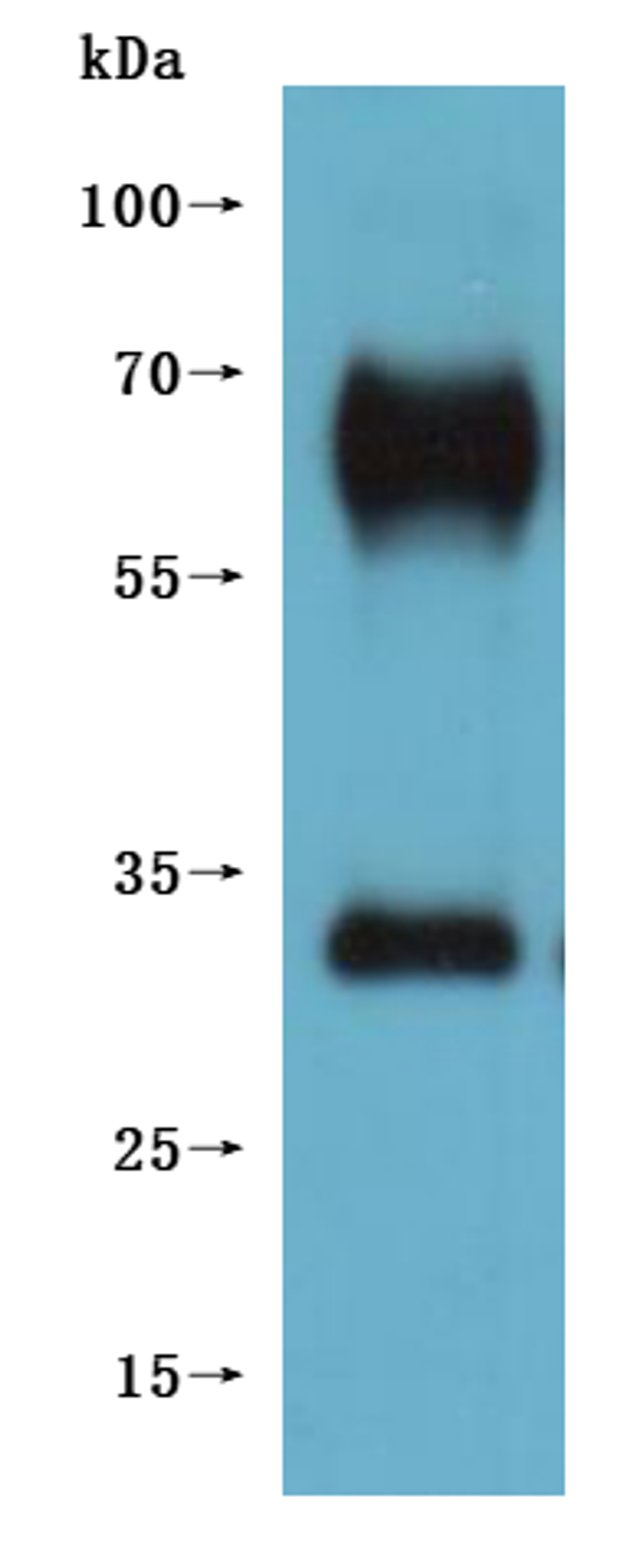 CSB-MP5431MOV is detected by Mouse anti-6*His monoclonal antibody.(This tag can be tested only under denaturing conditions.)