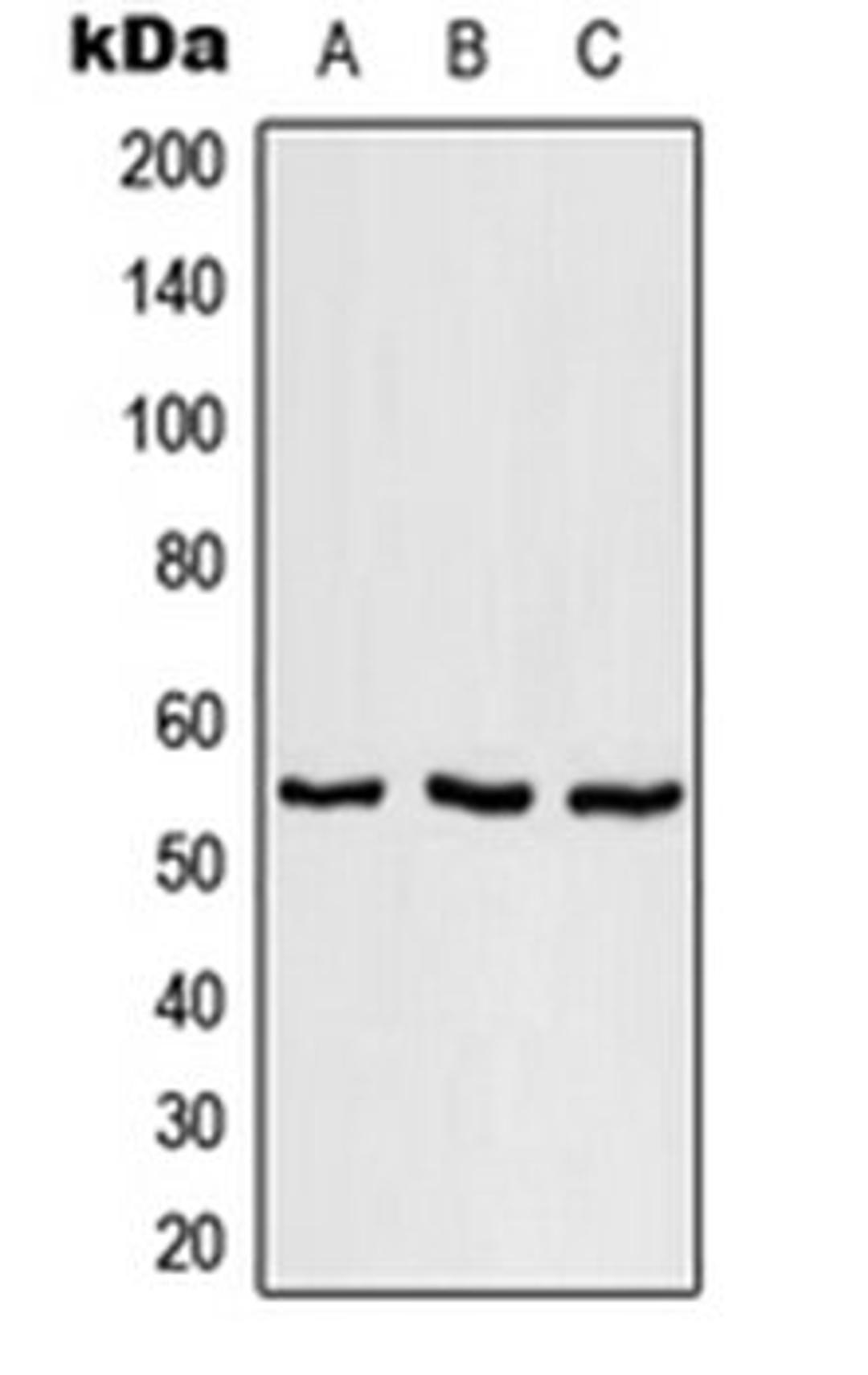 Western blot analysis of NCI-H292 (Lane 1), SP2/0 (Lane 2), H9C2 (Lane 3) whole cell lysates using SRSF11 antibody