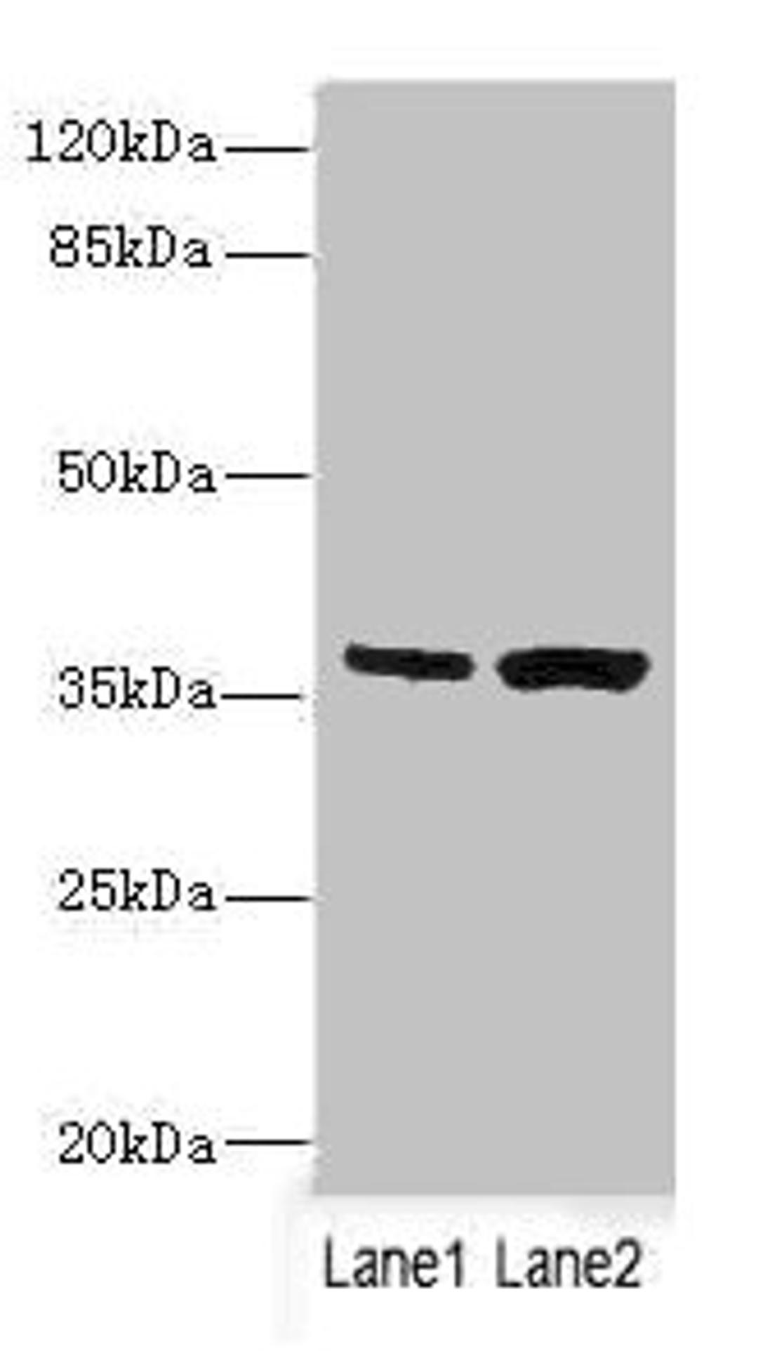 Western blot. All lanes: C1GALT1C1 antibody at 3.97ug/ml. Lane 1: Mouse gonadal tissue. Lane 2: Mouse liver tissue. Secondary. Goat polyclonal to rabbit IgG at 1/10000 dilution. Predicted band size: 36 kDa. Observed band size: 36 kDa.