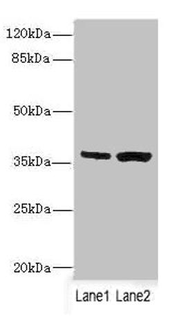 Western blot. All lanes: C1GALT1C1 antibody at 3.97ug/ml. Lane 1: Mouse gonadal tissue. Lane 2: Mouse liver tissue. Secondary. Goat polyclonal to rabbit IgG at 1/10000 dilution. Predicted band size: 36 kDa. Observed band size: 36 kDa.