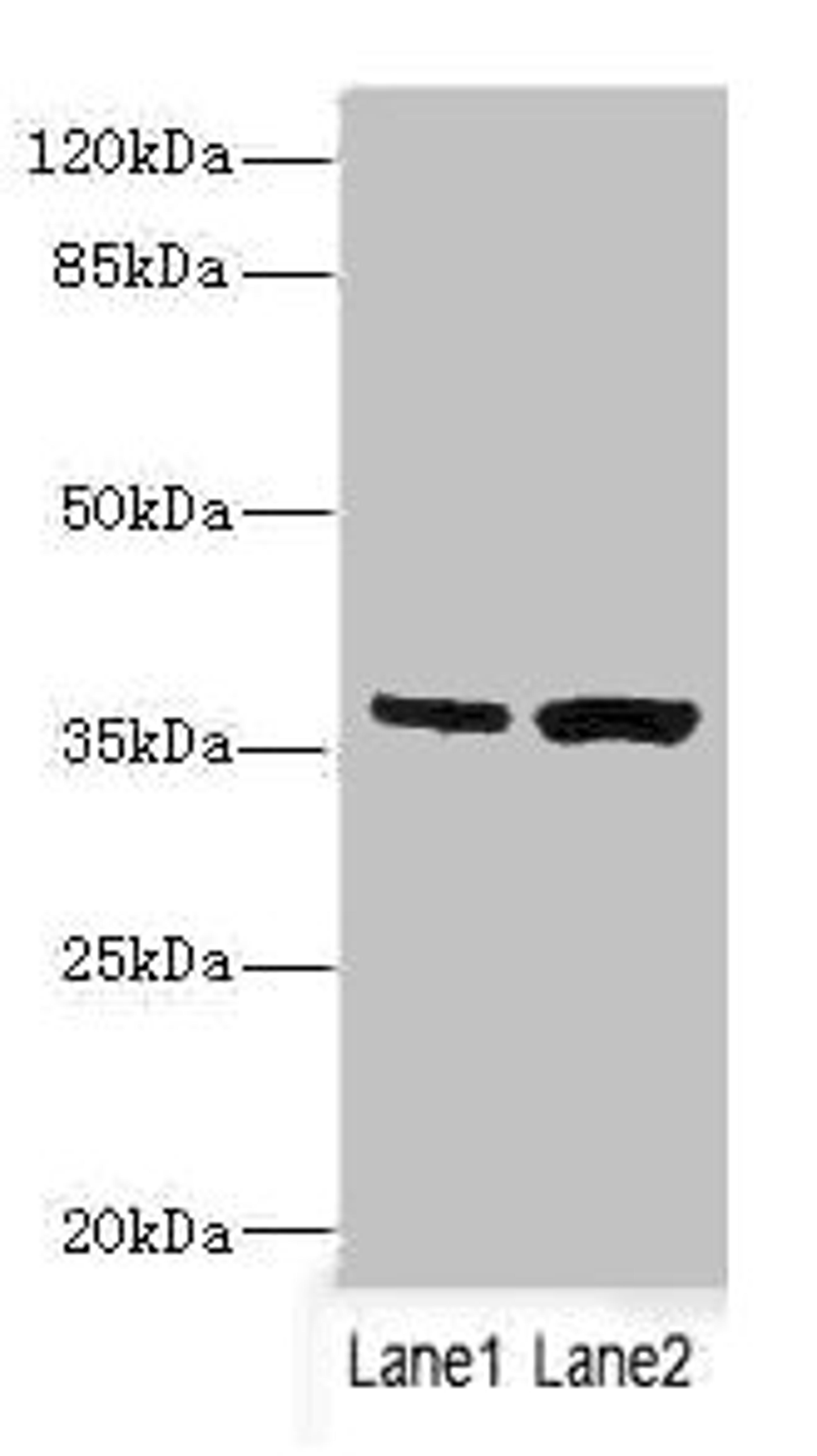 Western blot. All lanes: C1GALT1C1 antibody at 3.97ug/ml. Lane 1: Mouse gonadal tissue. Lane 2: Mouse liver tissue. Secondary. Goat polyclonal to rabbit IgG at 1/10000 dilution. Predicted band size: 36 kDa. Observed band size: 36 kDa.