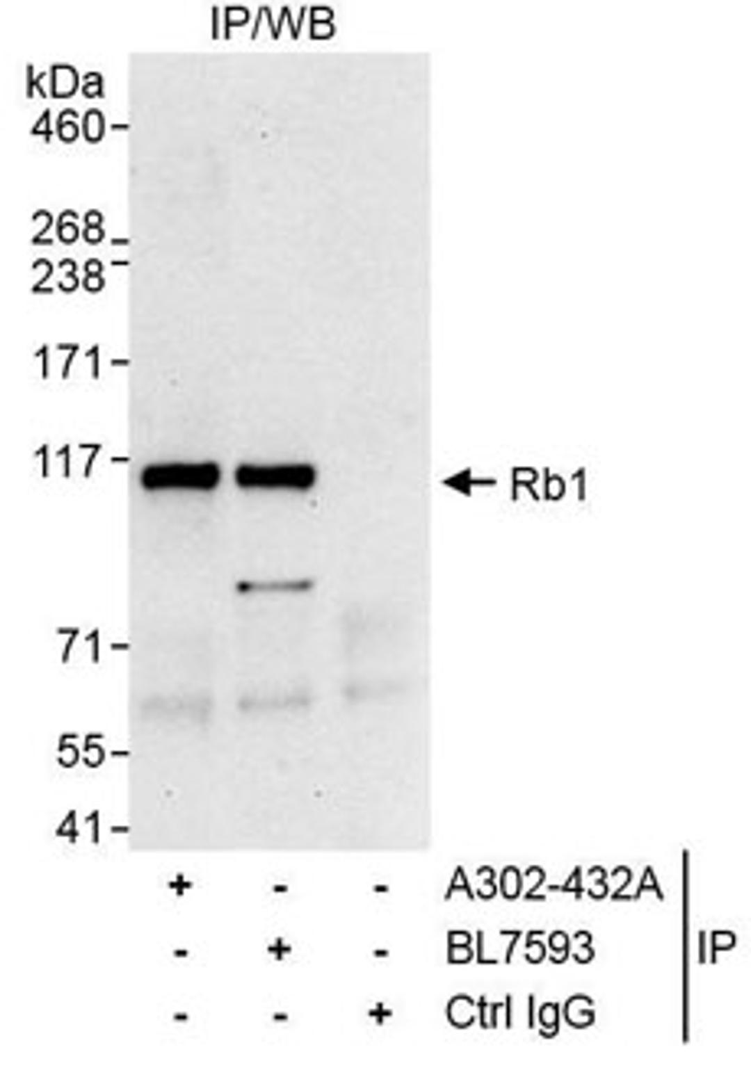 Detection of human Rb1 by western blot of immunoprecipitates.