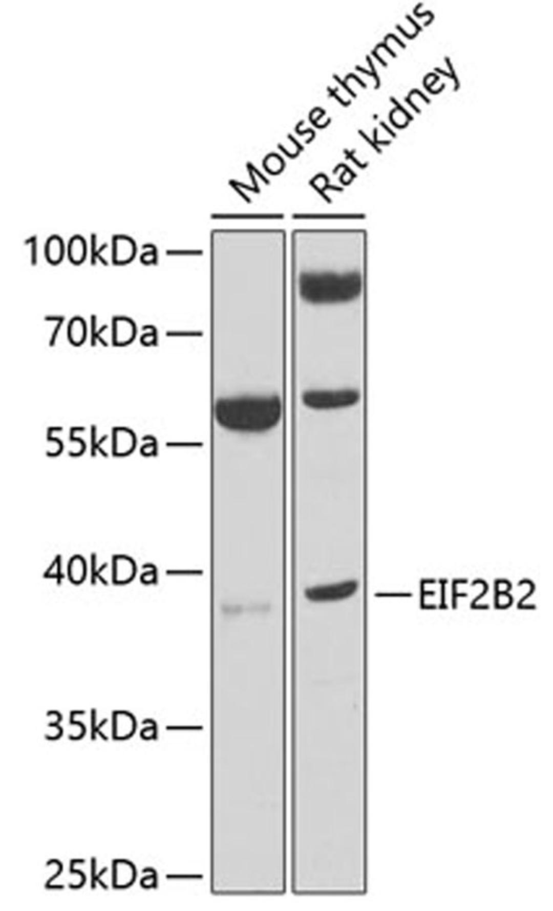 Western blot - EIF2B2 antibody (A7027)