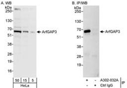 Detection of human ArfGAP3 by western blot and immunoprecipitation.