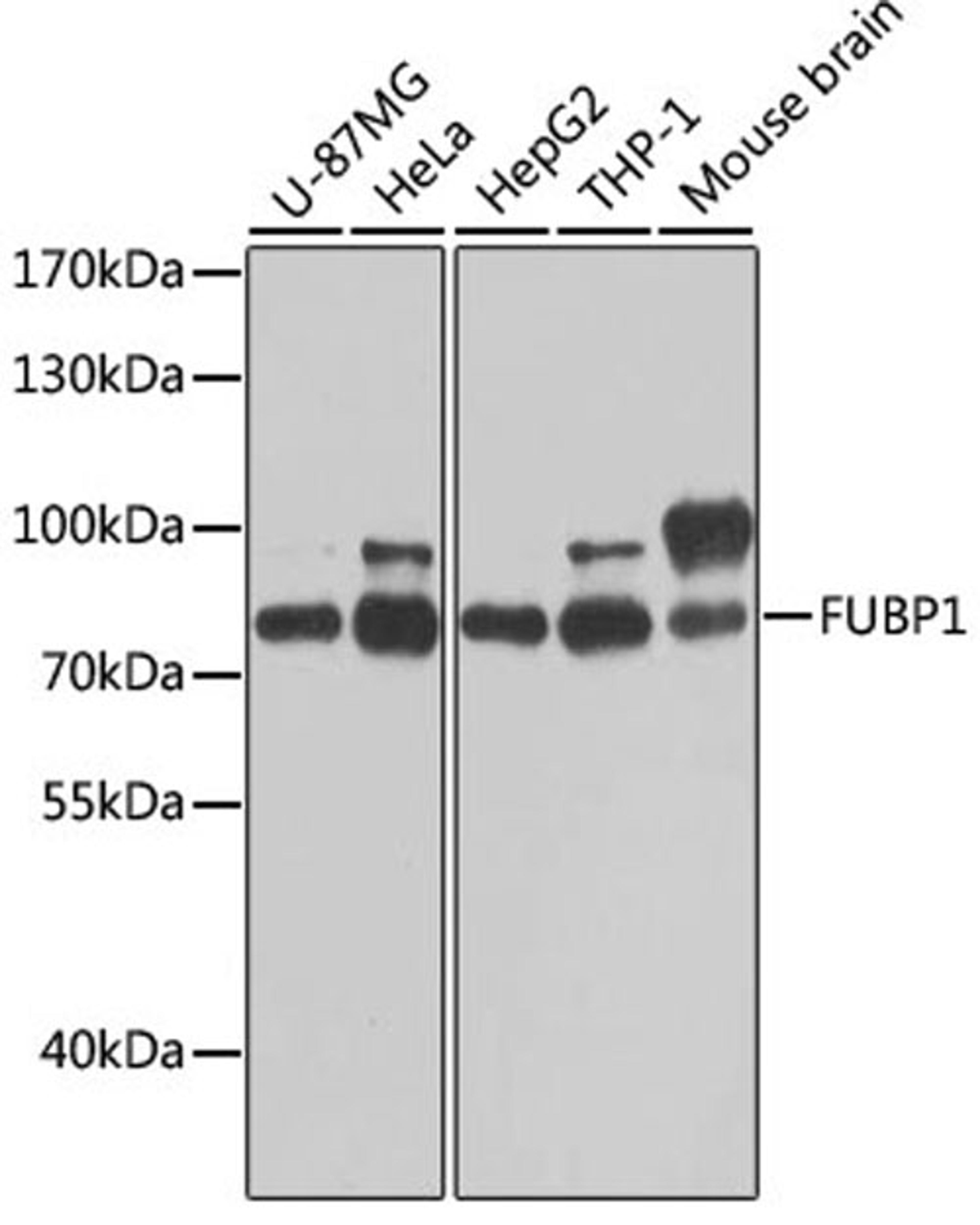 Western blot - FUBP1 antibody (A5587)