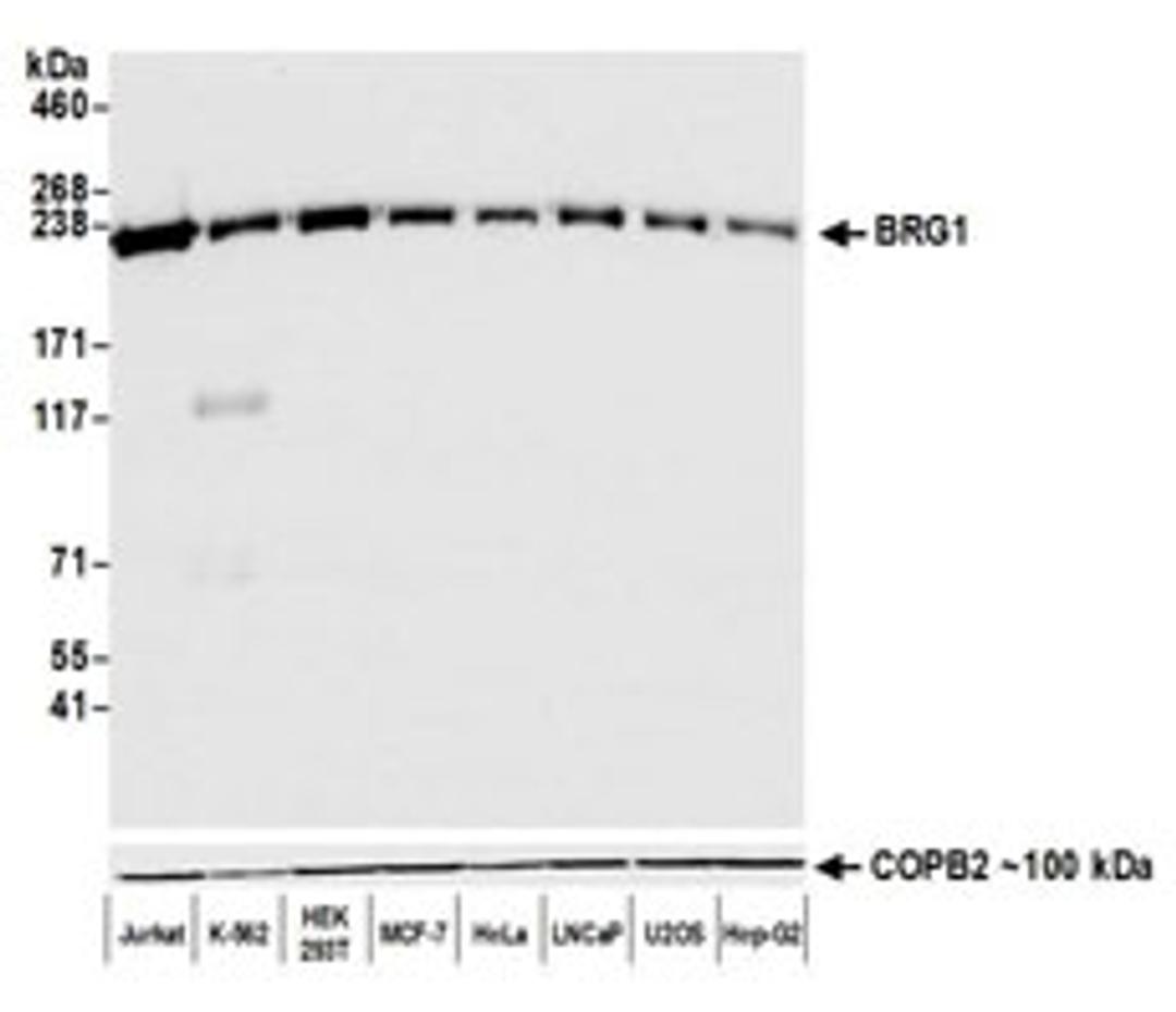 Detection of human BRG1 by western blot.