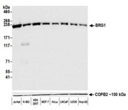 Detection of human BRG1 by western blot.