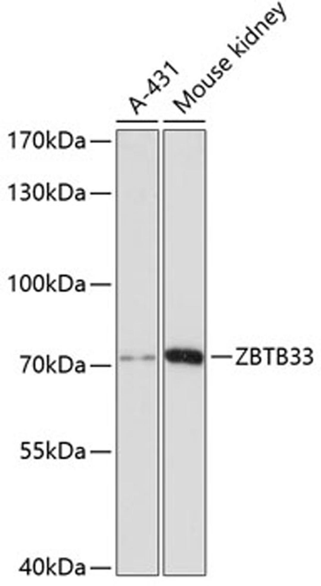 Western blot - ZBTB33 antibody (A12856)