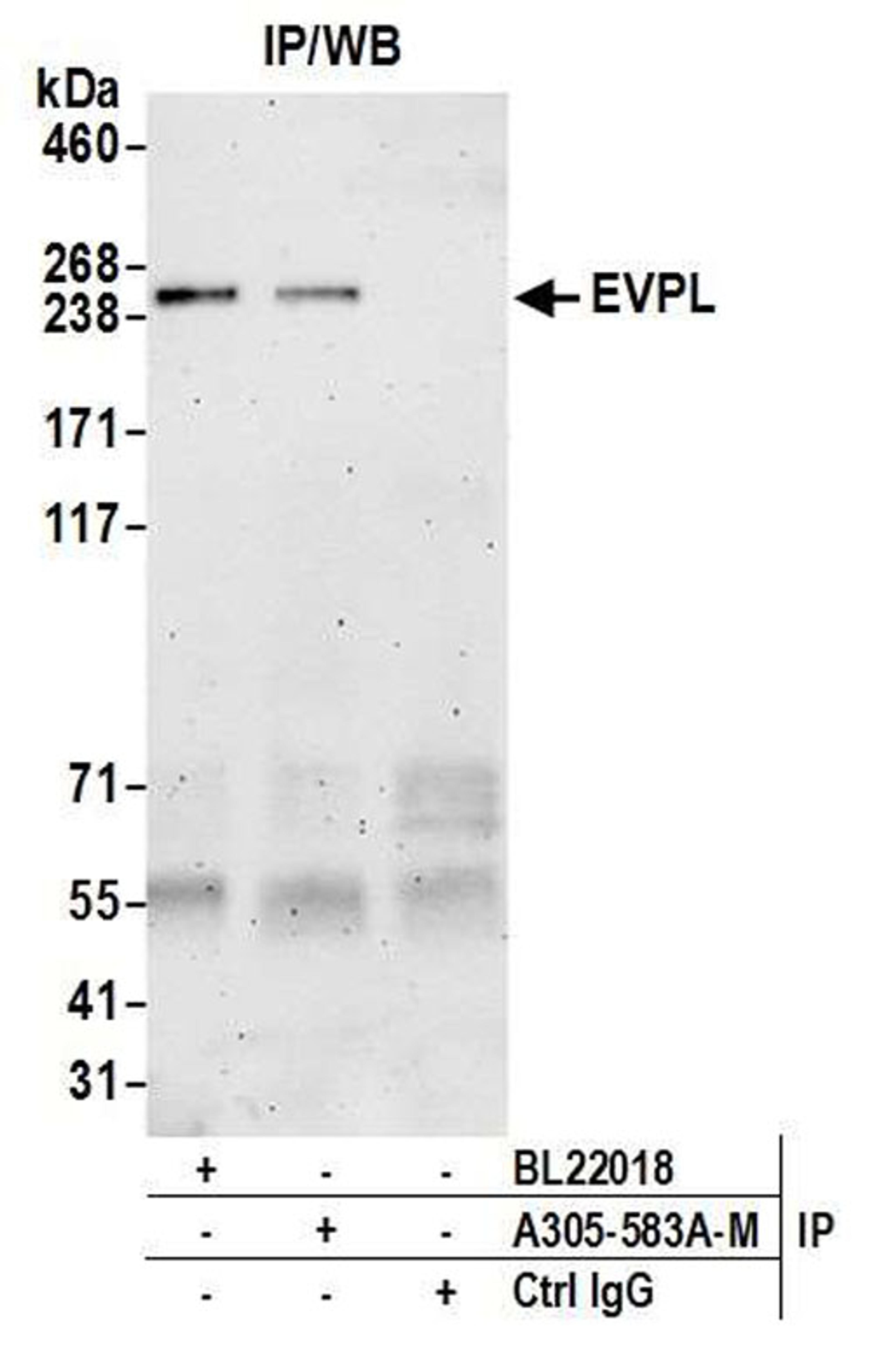 Detection of human EVPL by WB of IP.