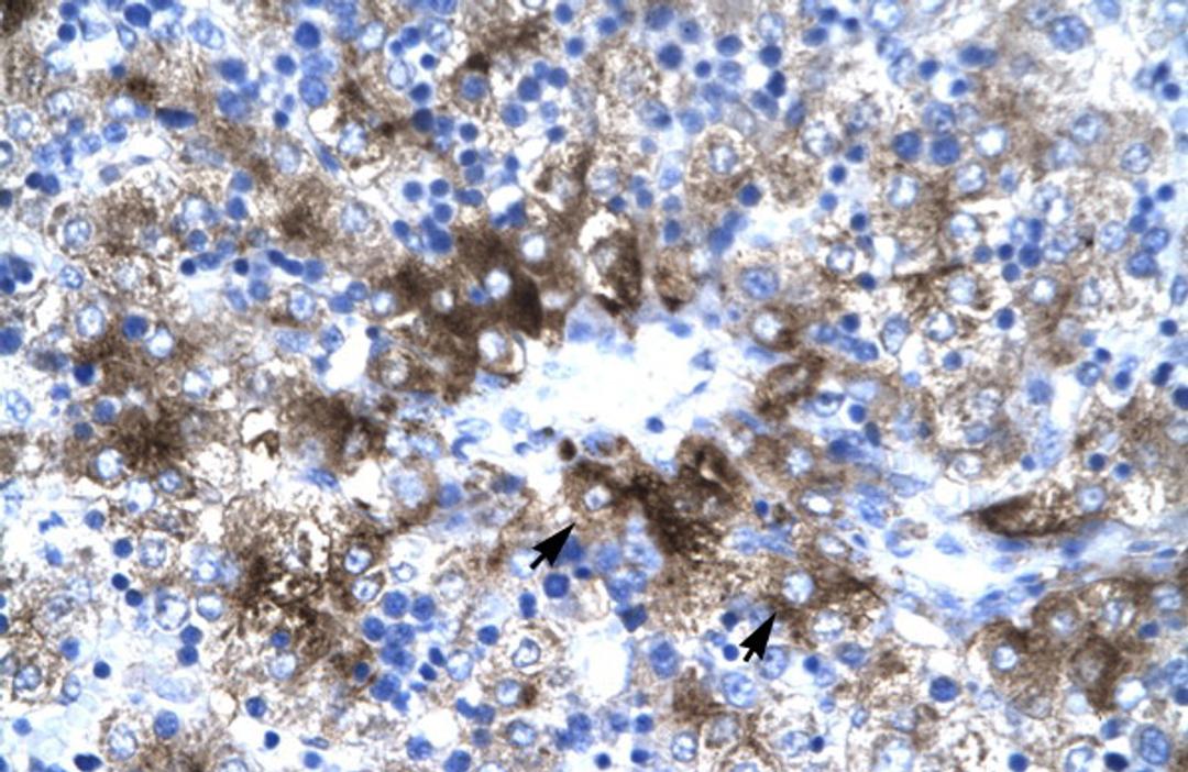 Antibody used in IHC on Human Liver.