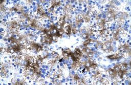 Antibody used in IHC on Human Liver.