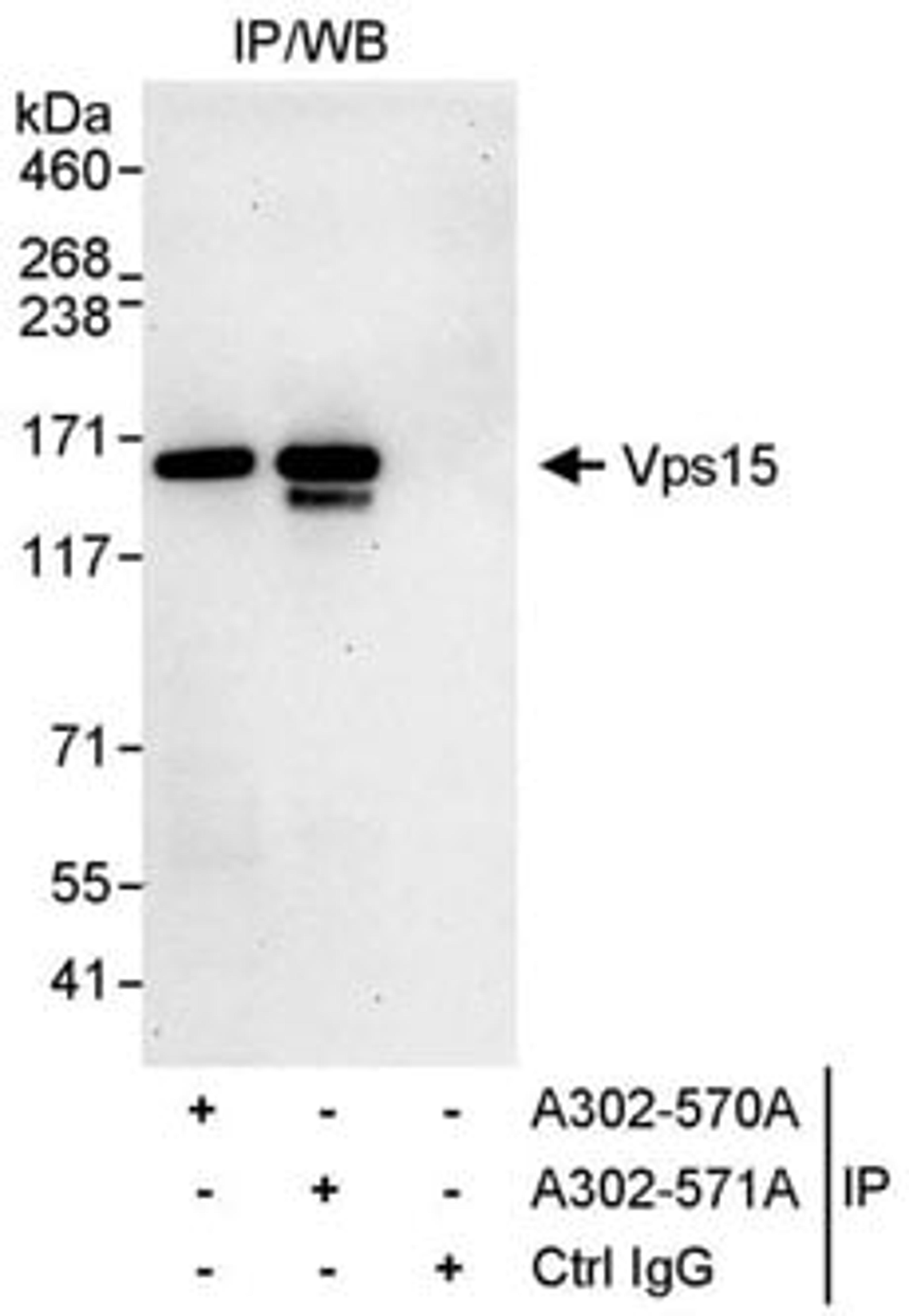 Detection of human Vps15 by western blot of immunoprecipitates.