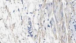 Immunohistochemistry-Paraffin: Collagen III alpha 1/COL3A1 Antibody (1E7-D7/Col3) [NBP1-05119] - Human bronchus tissue