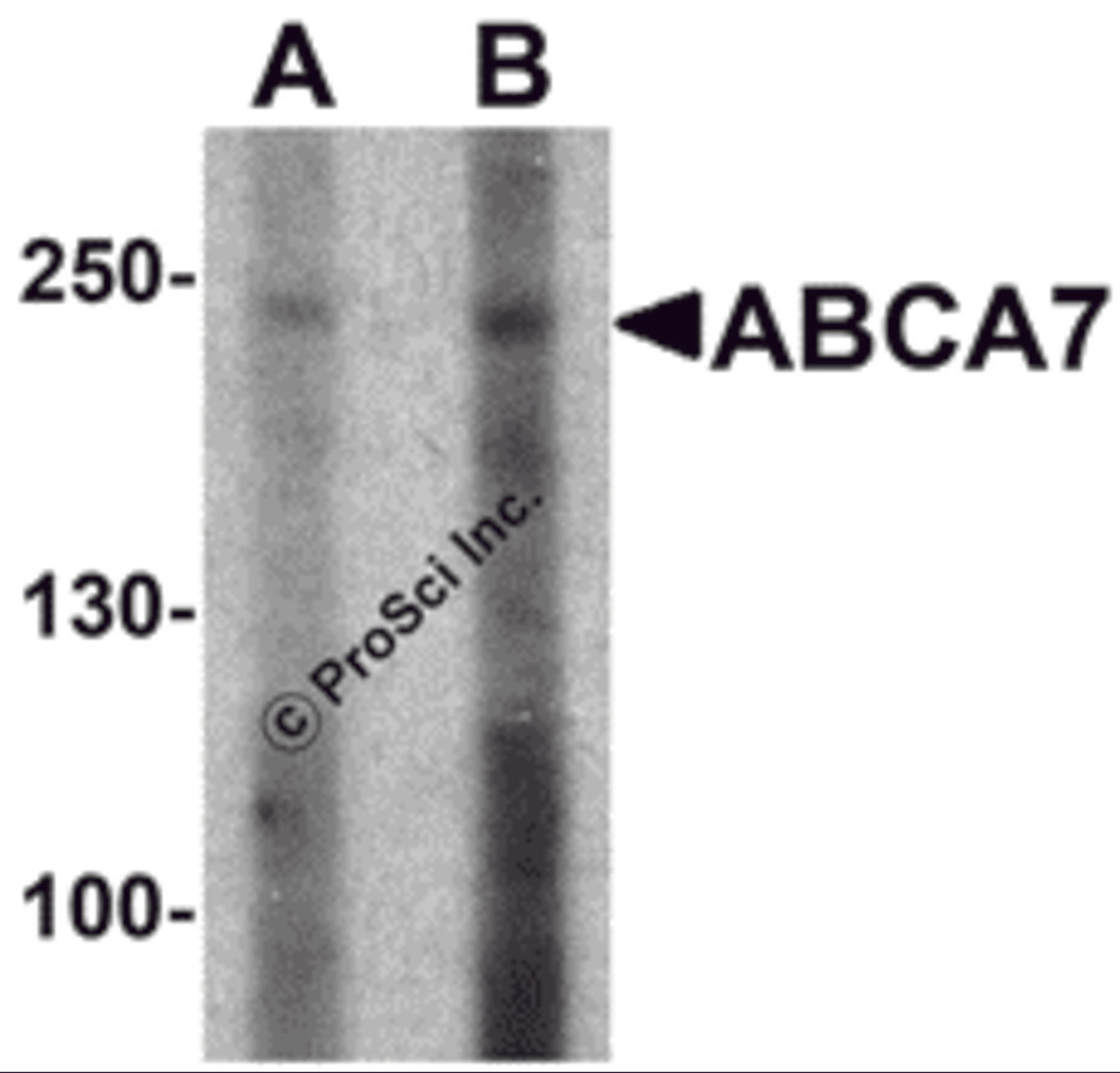 Western blot analysis of ABCA7 in 293 cell lysate with ABCA7 antibody at (A) 1 and (B) 2 μg/mL.