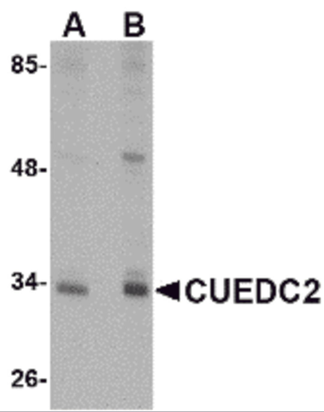 Western blot analysis of CUEDC2 in HeLa cell lysate with CUEDC2 antibody at (A) 1 and (B) 2 μg/mL.