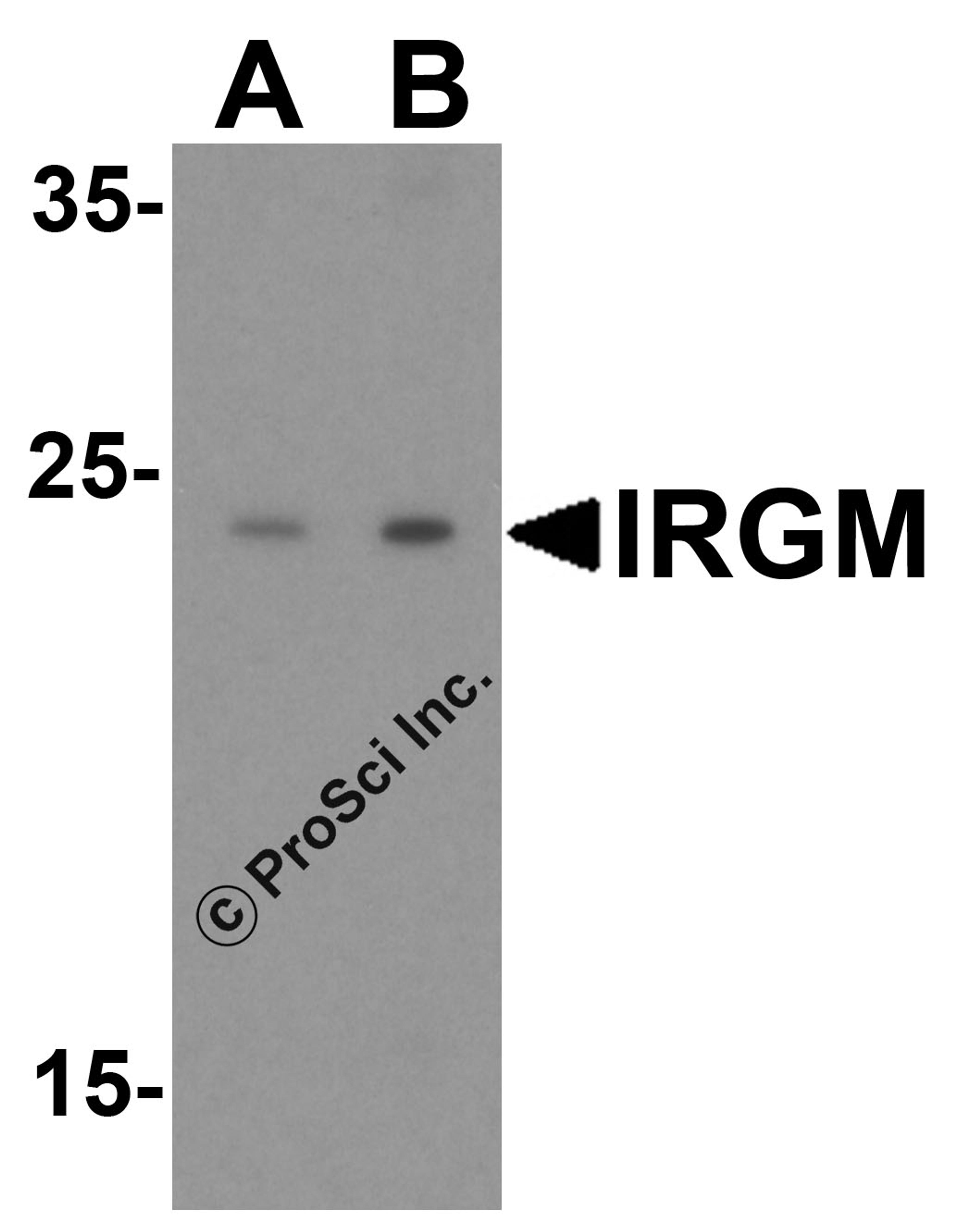 Western blot analysis of IRGM in human brain lysate with IRGM antibody at (A) 1 and (B) 2 μg/mL.