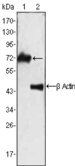 Western Blot: ZAP70 Antibody (3D2A4) [NB110-60490] - Analysis using ZAP70 mouse mAb against Jurkat cell lysate (1).