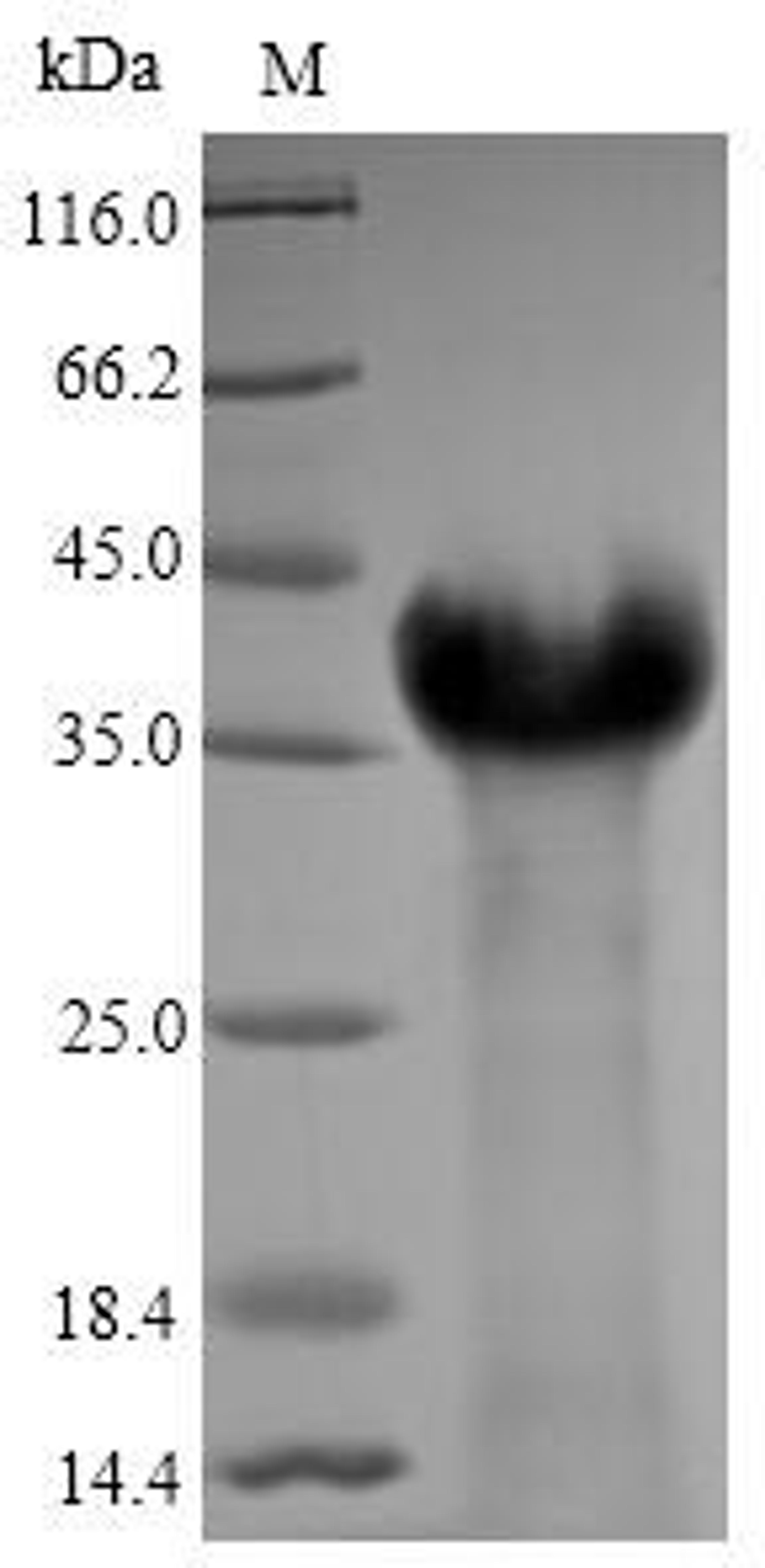 (Tris-Glycine gel) Discontinuous SDS-PAGE (reduced) with 5% enrichment gel and 15% separation gel.