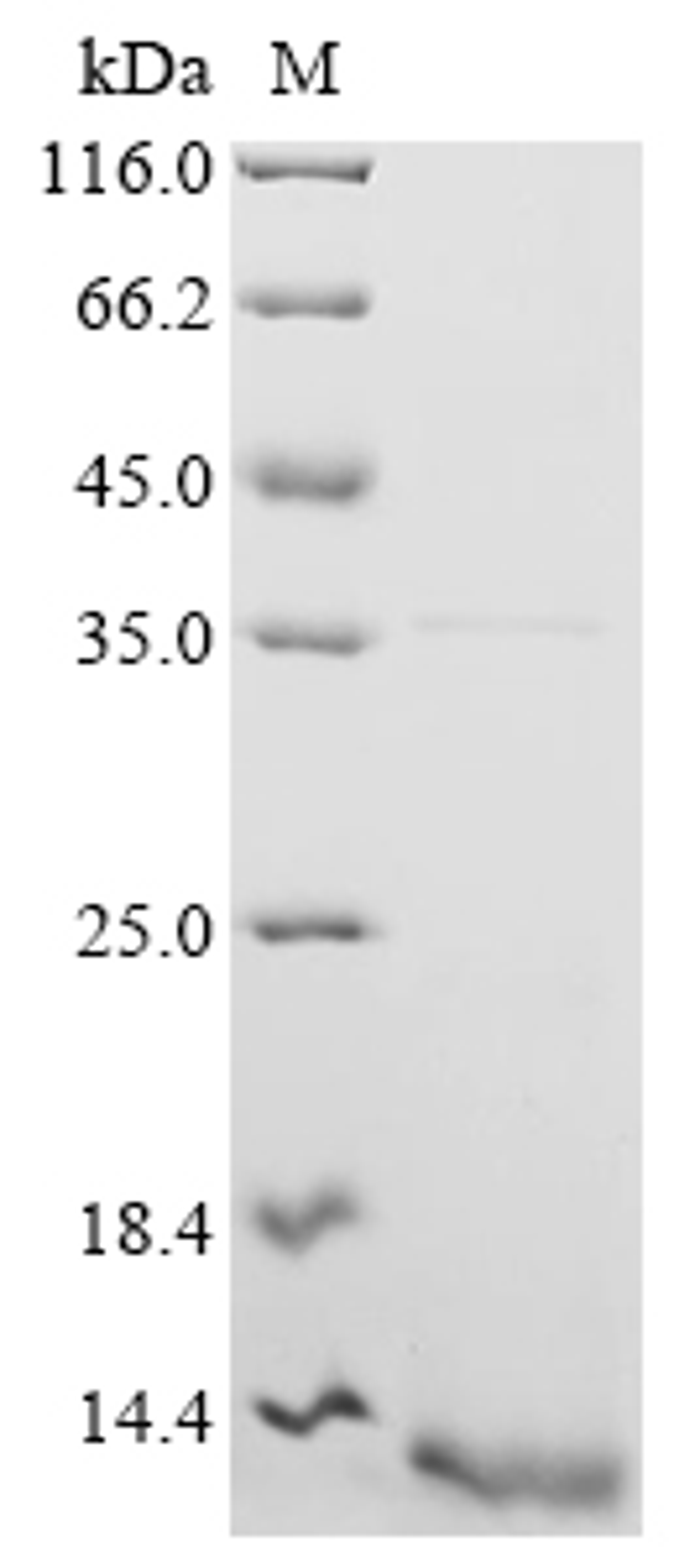 (Tris-Glycine gel) Discontinuous SDS-PAGE (reduced) with 5% enrichment gel and 15% separation gel.