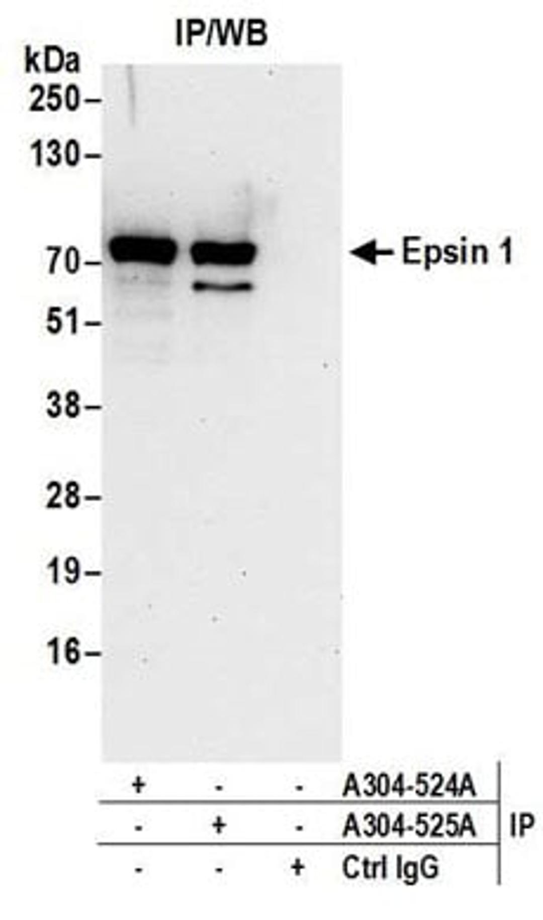 Detection of human Epsin 1 by western blot of immunoprecipitates.