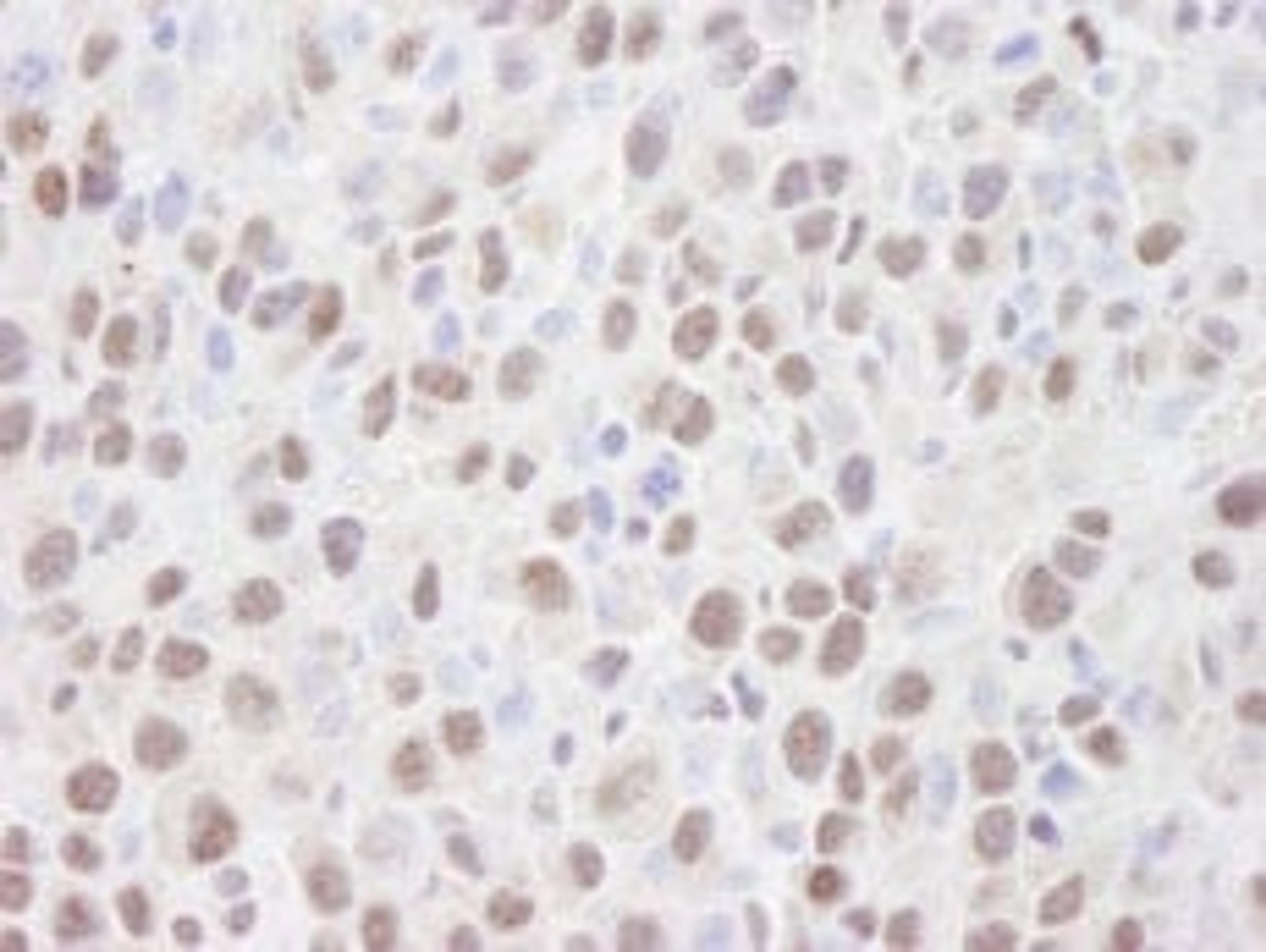 Detection of mouse HDAC2 by immunohistochemistry.