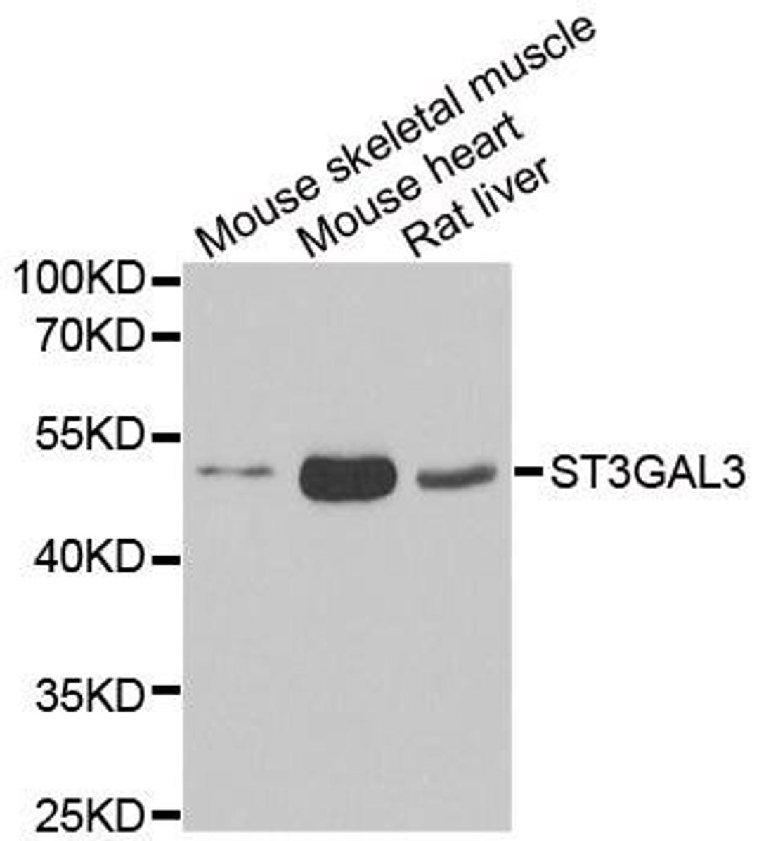 Western blot analysis of extracts of various cell lines using ST3GAL3 antibody