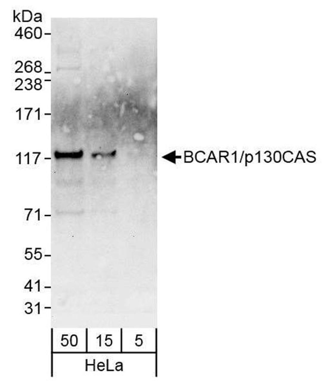 Detection of human BCAR1/p130CAS by western blo.