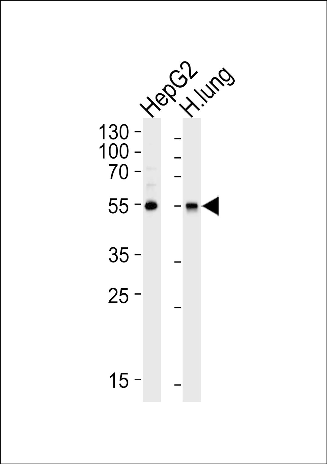 Western blot analysis of lysates from HepG2 cell line and human lung tissue lysate (from left to right), using ALDH1A1 Antibody at 1:1000 at each lane.