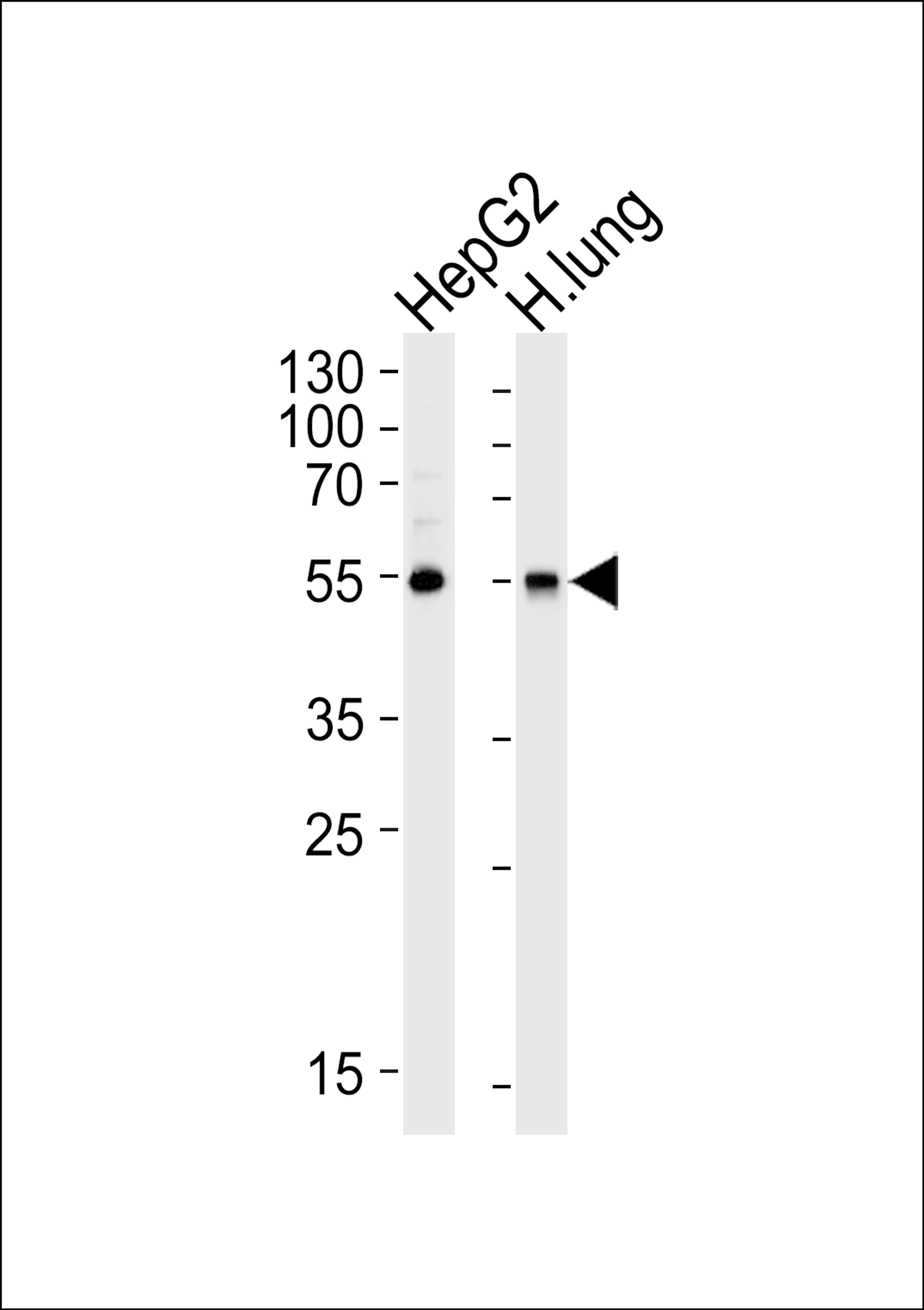 Western blot analysis of lysates from HepG2 cell line and human lung tissue lysate (from left to right), using ALDH1A1 Antibody at 1:1000 at each lane.