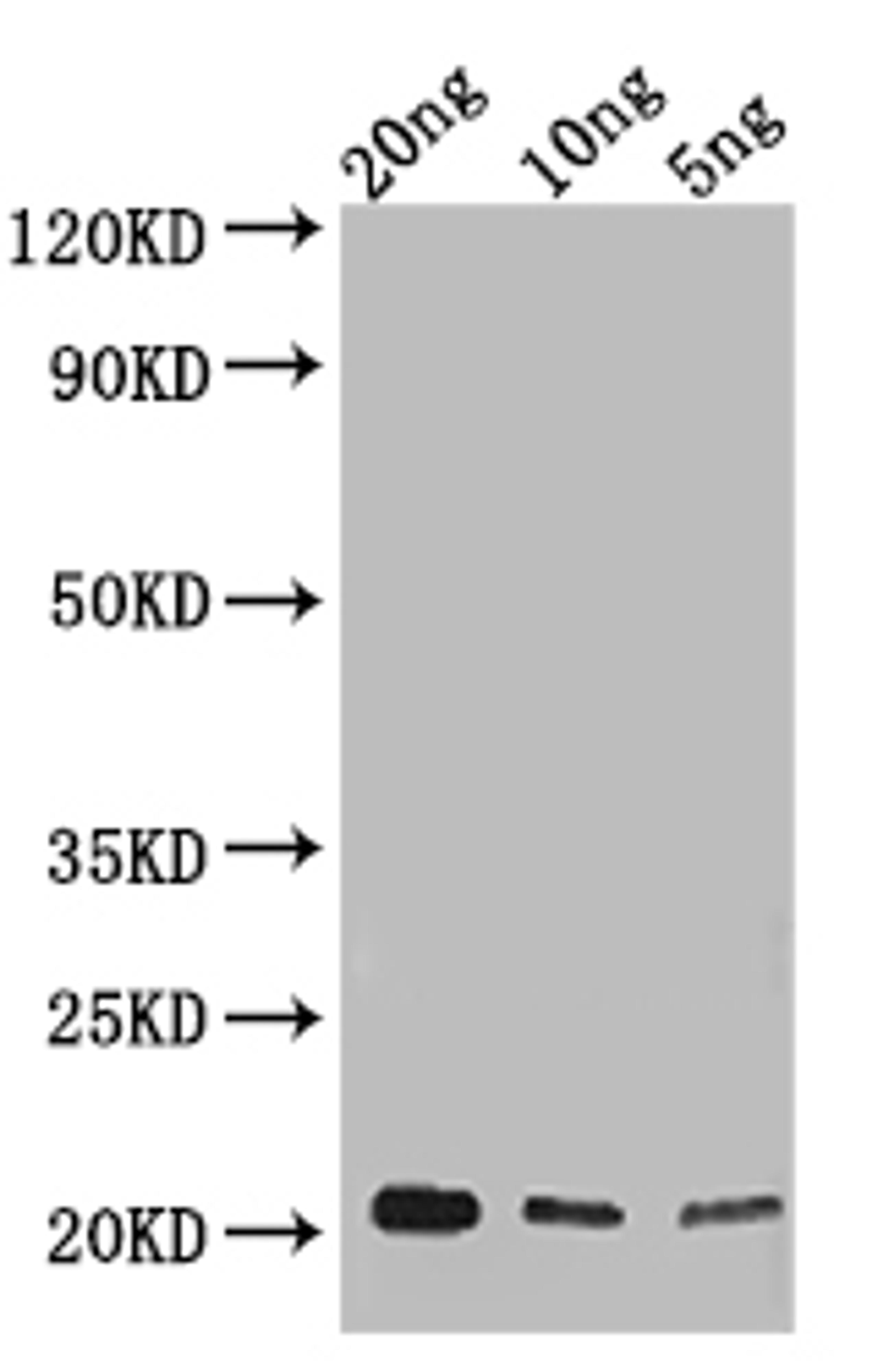 Western Blot. Positive WB detected in: recombinant protein. All lanes: NUP62 Antibody at 1:1000. Secondary. Goat polyclonal to rabbit IgG at 1/50000 dilution. Predicted band size: 18 kDa. Observed band size: 22 kDa. 