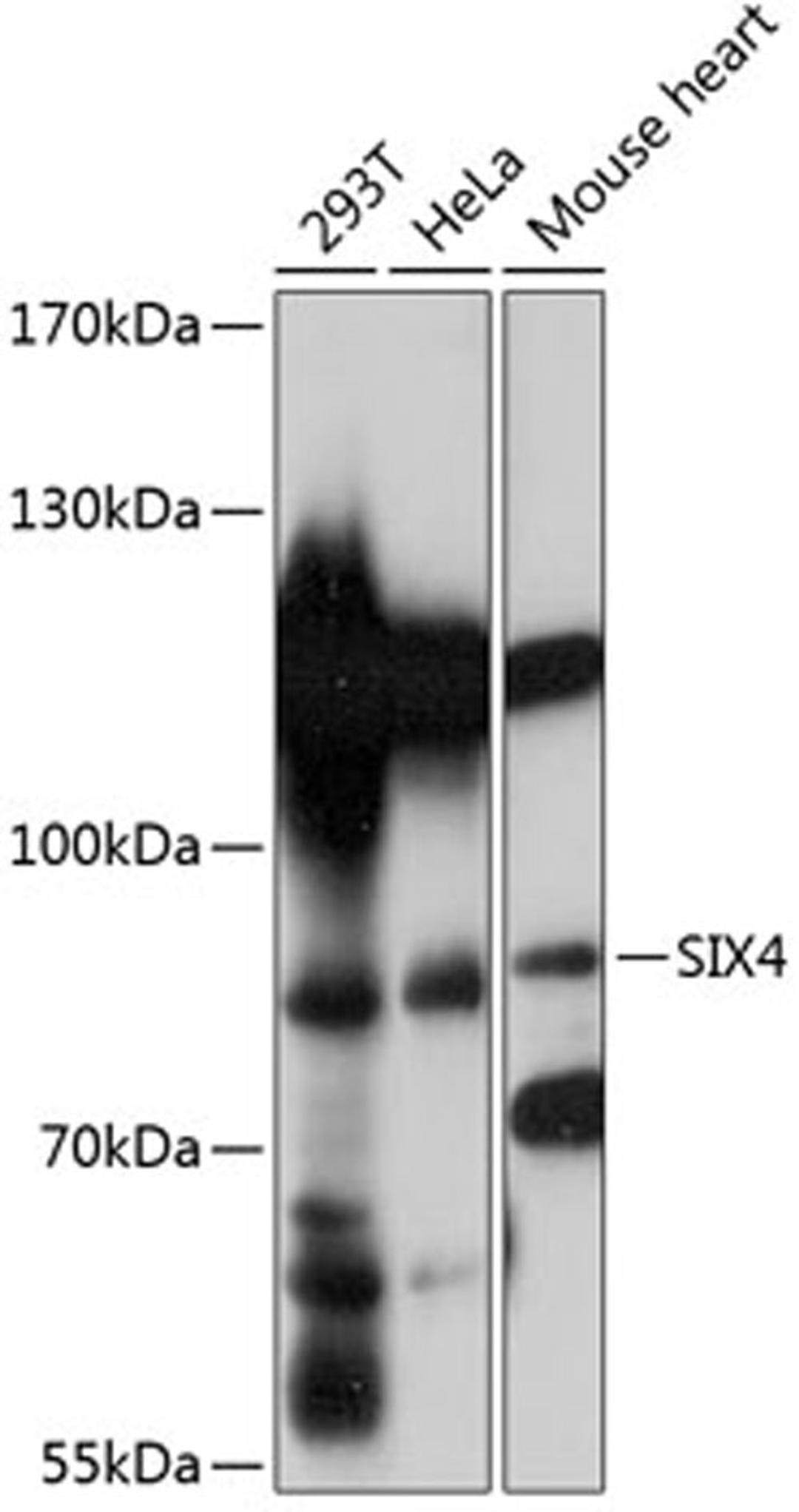 Western blot - SIX4 antibody (A14406)