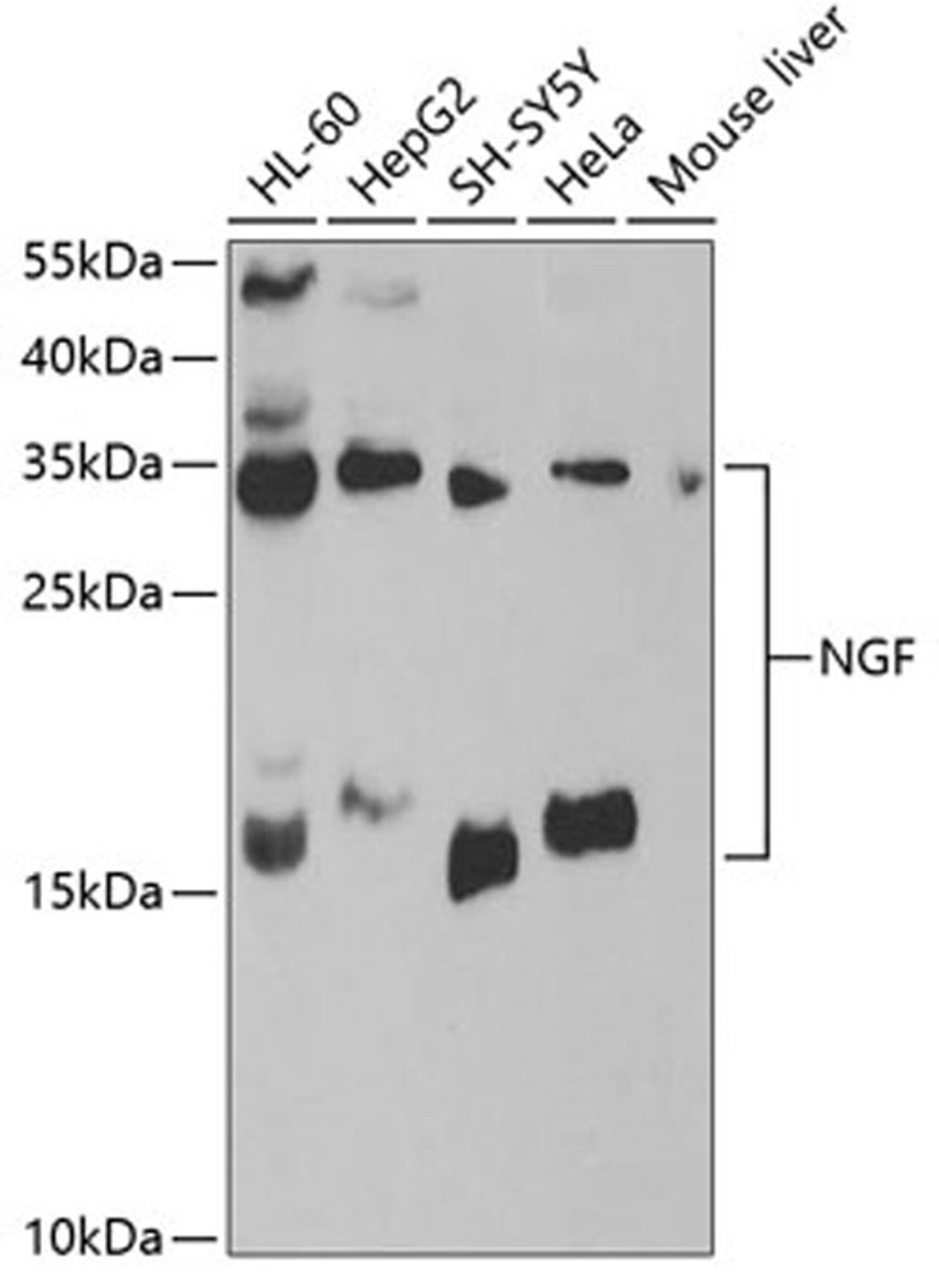 Western blot - NGF antibody (A0258)