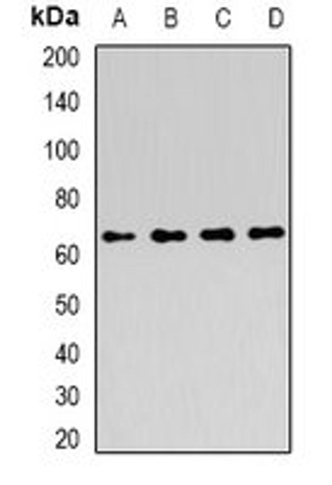 Western blot analysis of MCF7 (Lane1), HepG2 (Lane2), HT29 (Lane3), K562 (Lane4) whole cell lysates using ATIC antibody