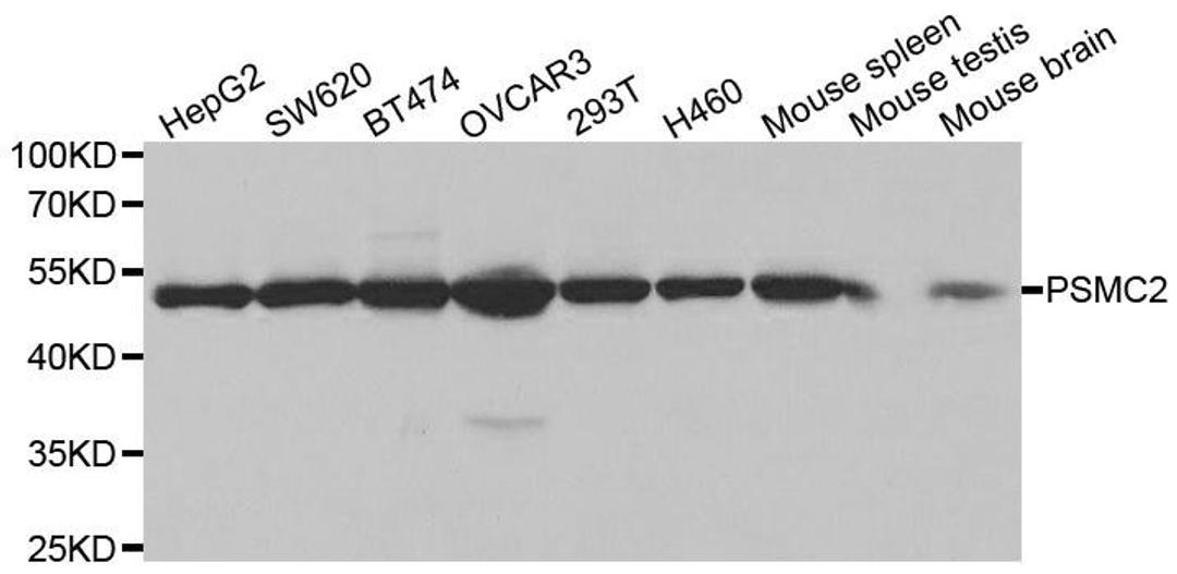 Western blot analysis of extracts of various cell lines using PSMC2 antibody