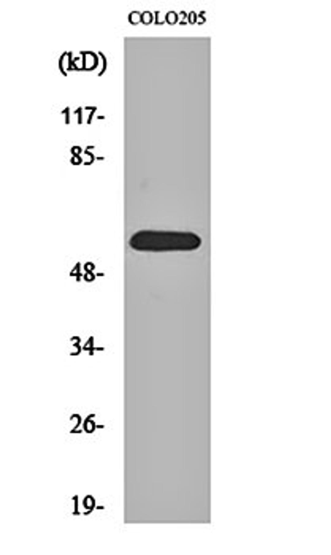 Western blot analysis of COLO205 cell lysates using GDF-9 antibody