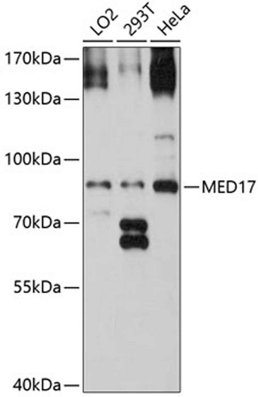 Western blot - MED17 antibody (A8716)