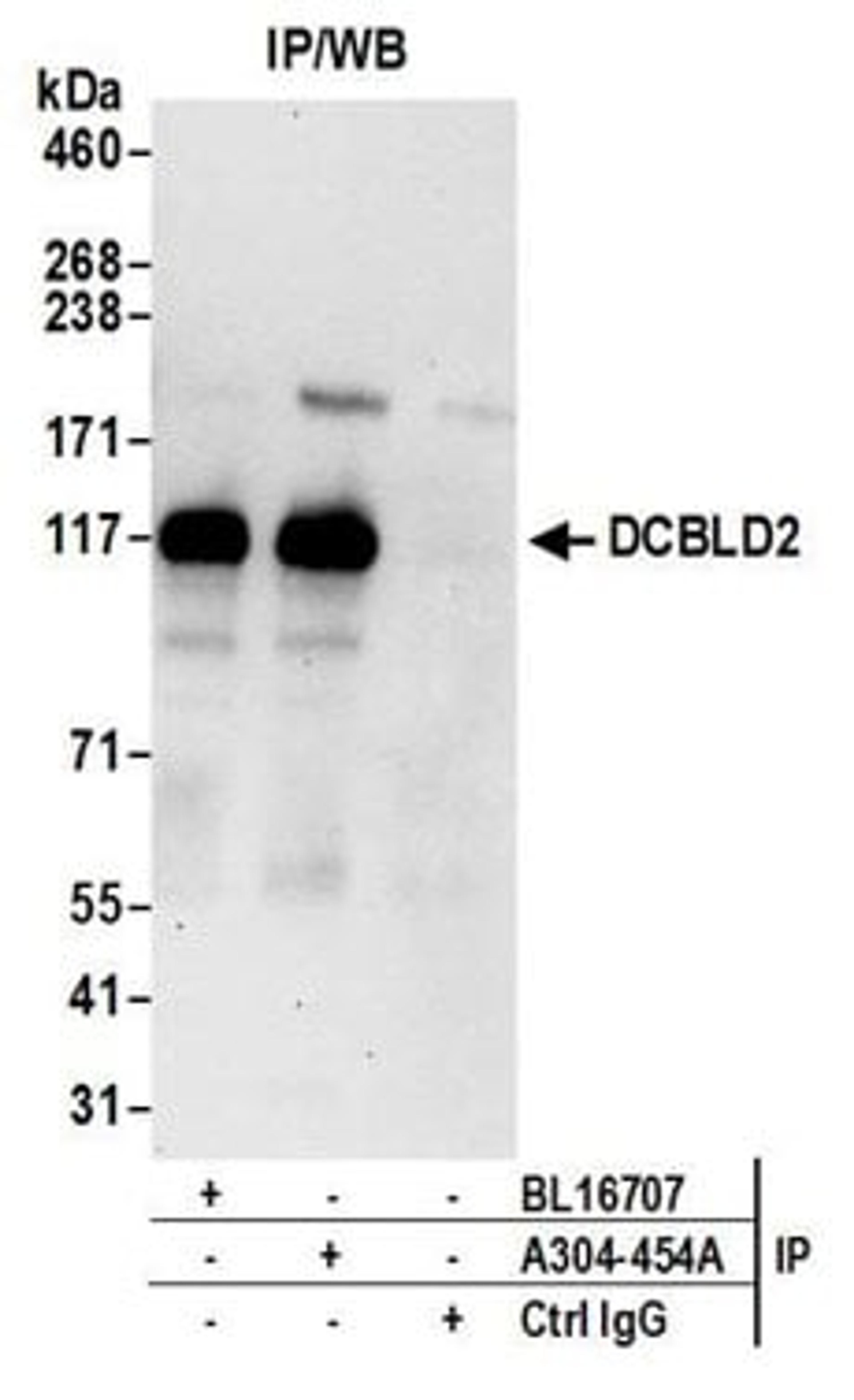 Detection of human DCBLD2 by western blot of immunoprecipitates.