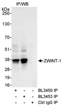 Detection of human ZWINT-1 by western blot of immunoprecipitates.