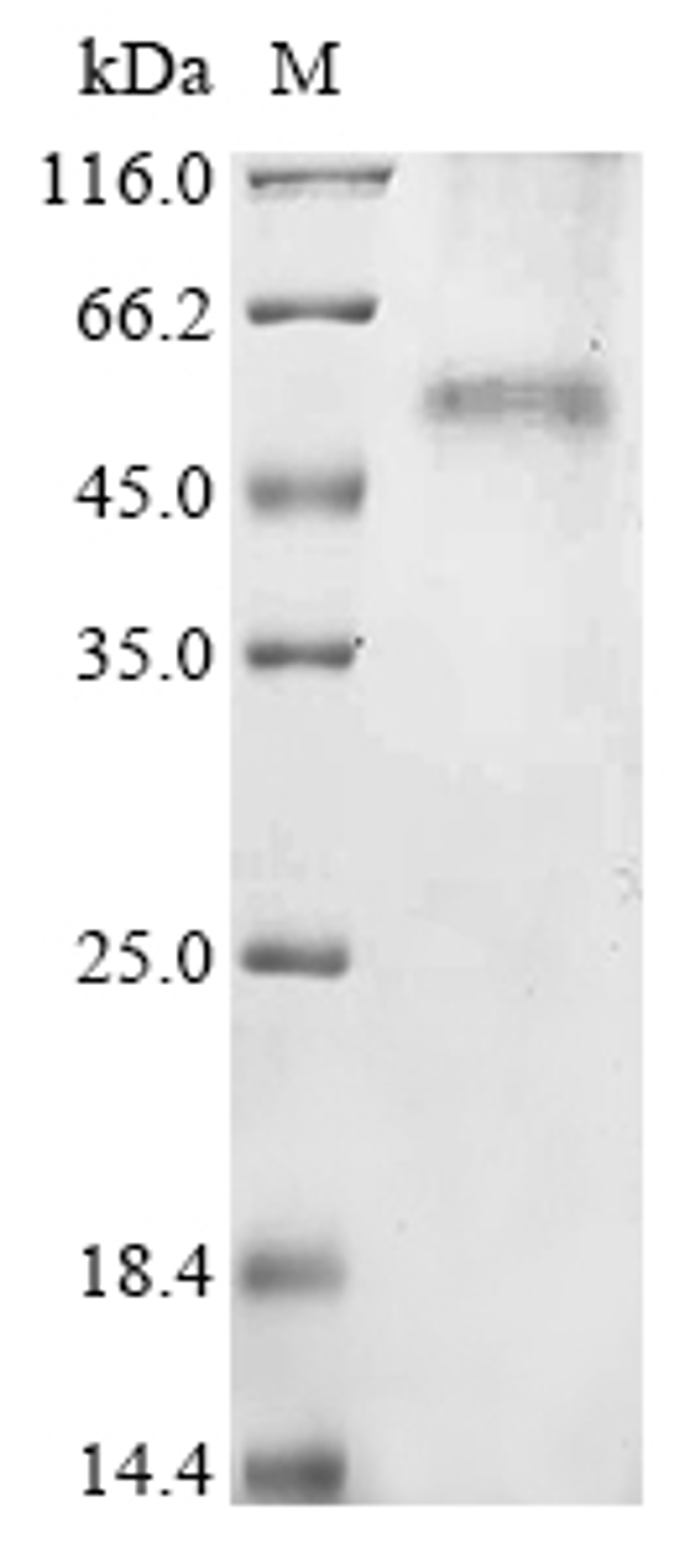 (Tris-Glycine gel) Discontinuous SDS-PAGE (reduced) with 5% enrichment gel and 15% separation gel.