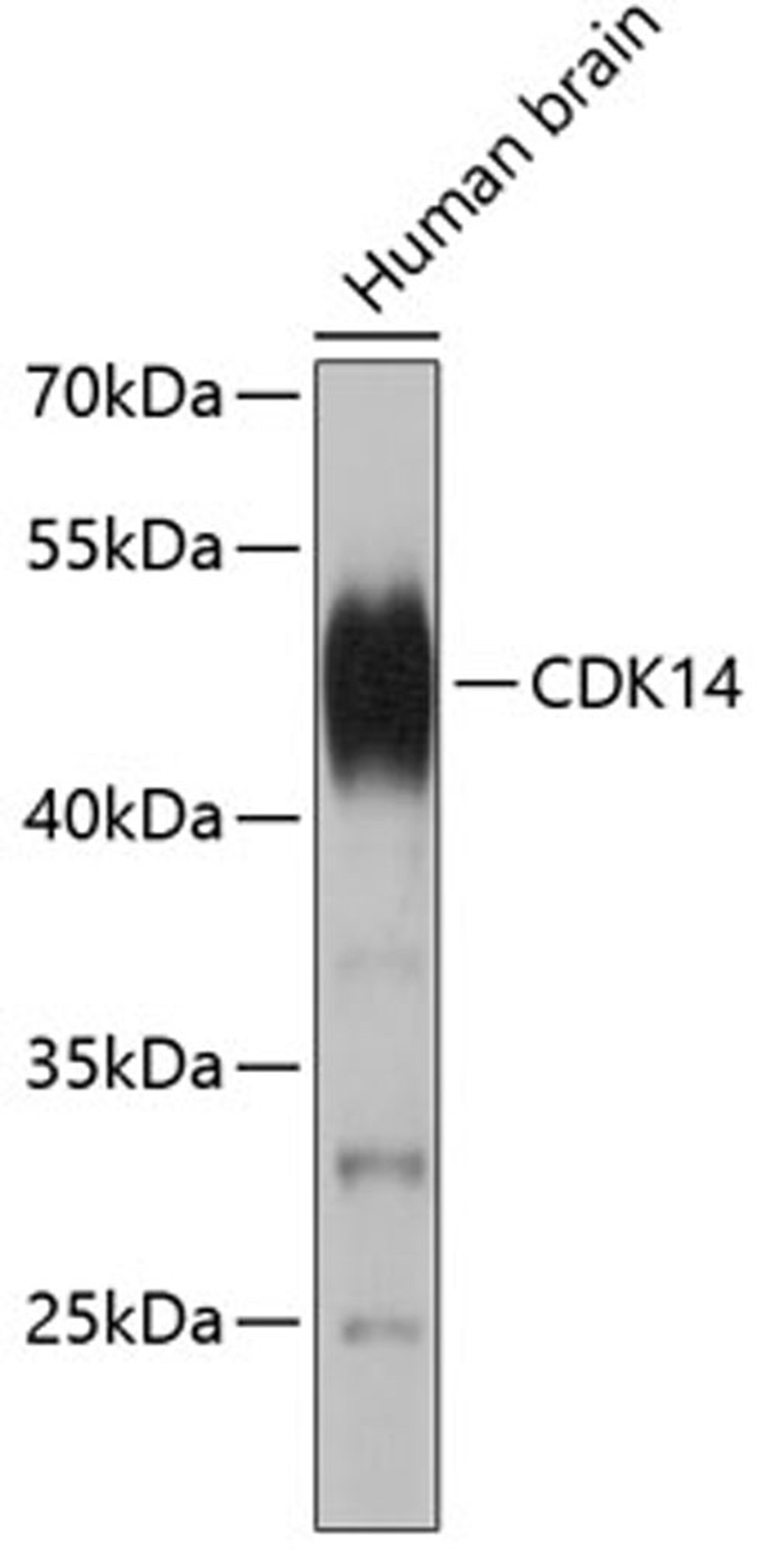 Western blot - CDK14 antibody (A3318)
