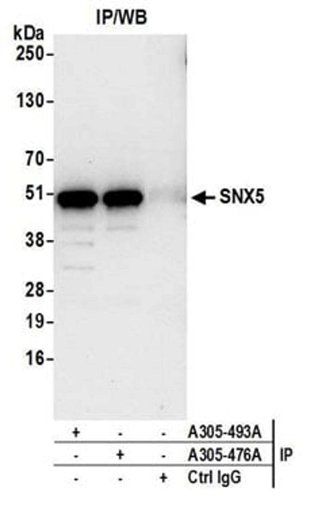 Detection of human SNX5 by western blot of immunoprecipitates.