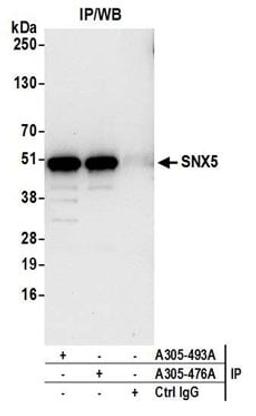 Detection of human SNX5 by western blot of immunoprecipitates.