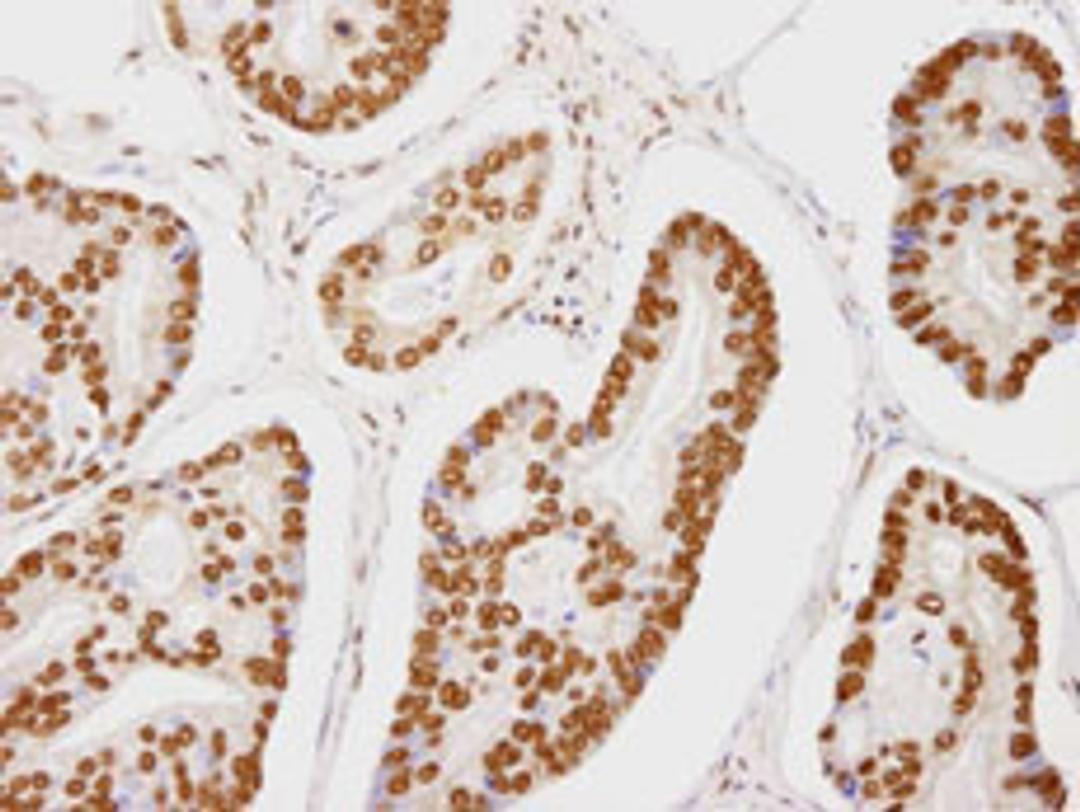 Detection of human CA150 by immunohistochemistry.