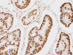 Detection of human CA150 by immunohistochemistry.