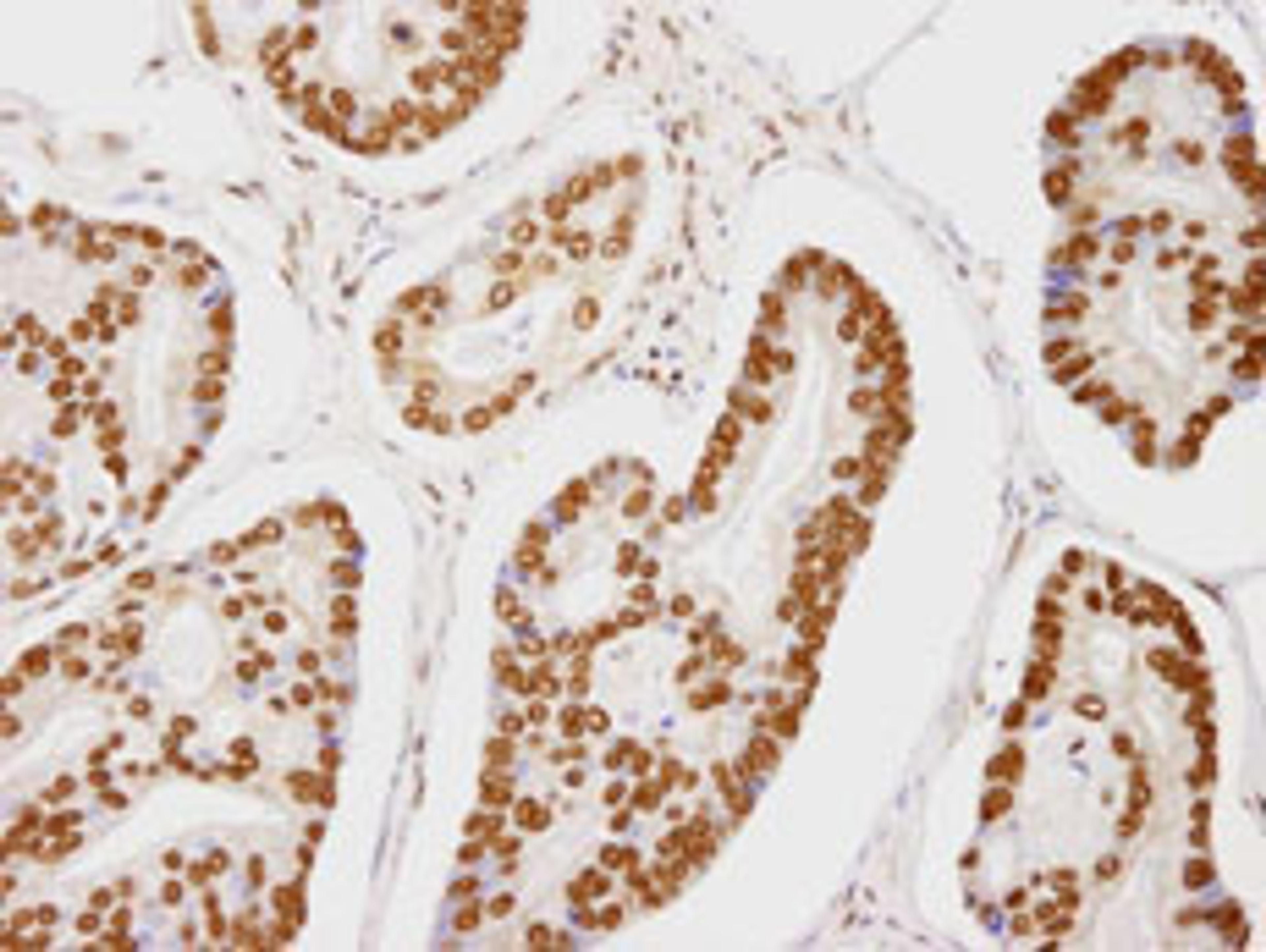 Detection of human CA150 by immunohistochemistry.