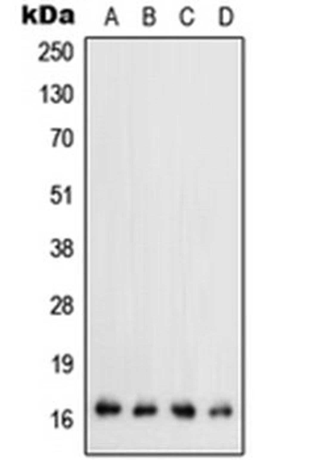 Western blot analysis of HEK293T (Lane 1), mouse liver (Lane 2), mouse kidney (Lane 3), rat kidney (Lane 4) whole cell lysates using TGFA antibody