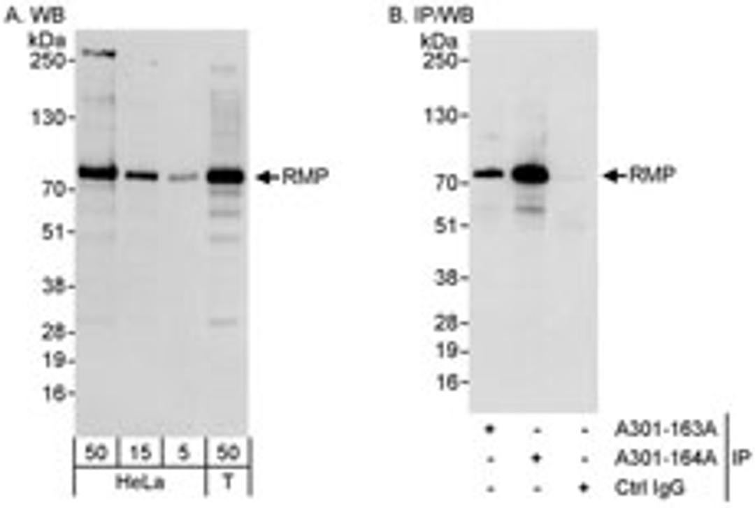 Detection of human RMP by western blot and immunoprecipitation.