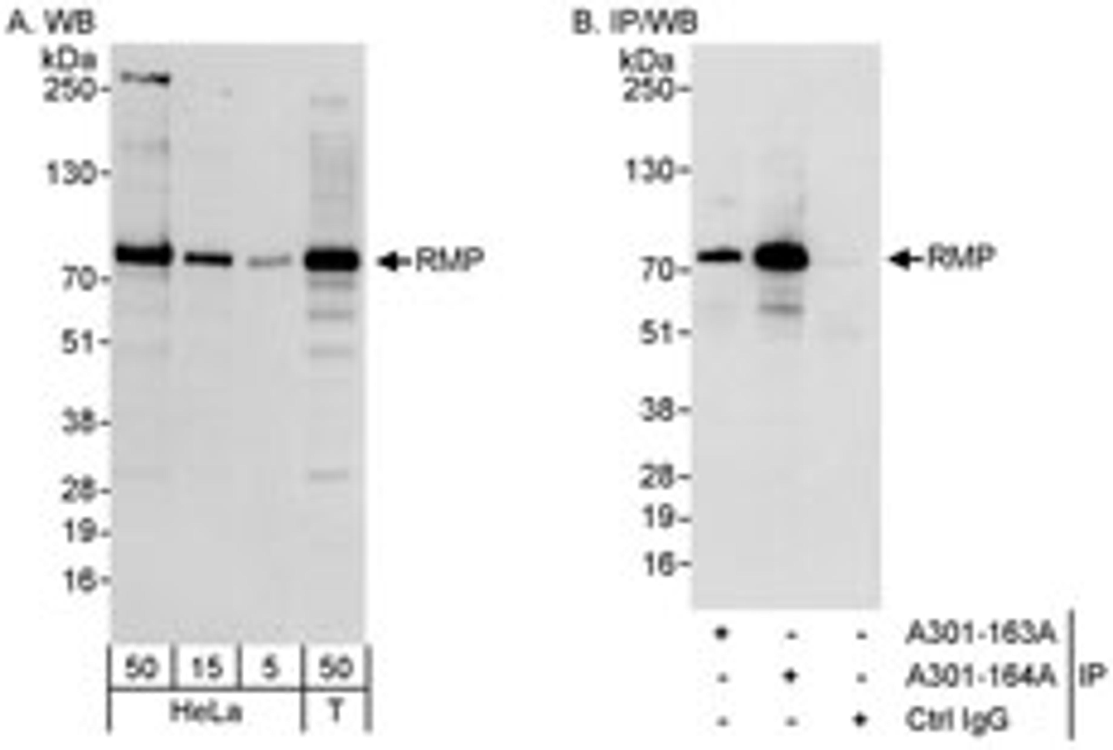 Detection of human RMP by western blot and immunoprecipitation.