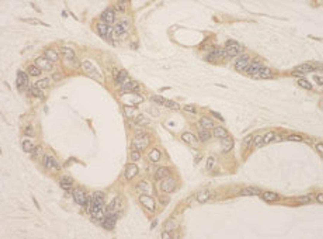 Detection of human CASC3 by immunohistochemistry.