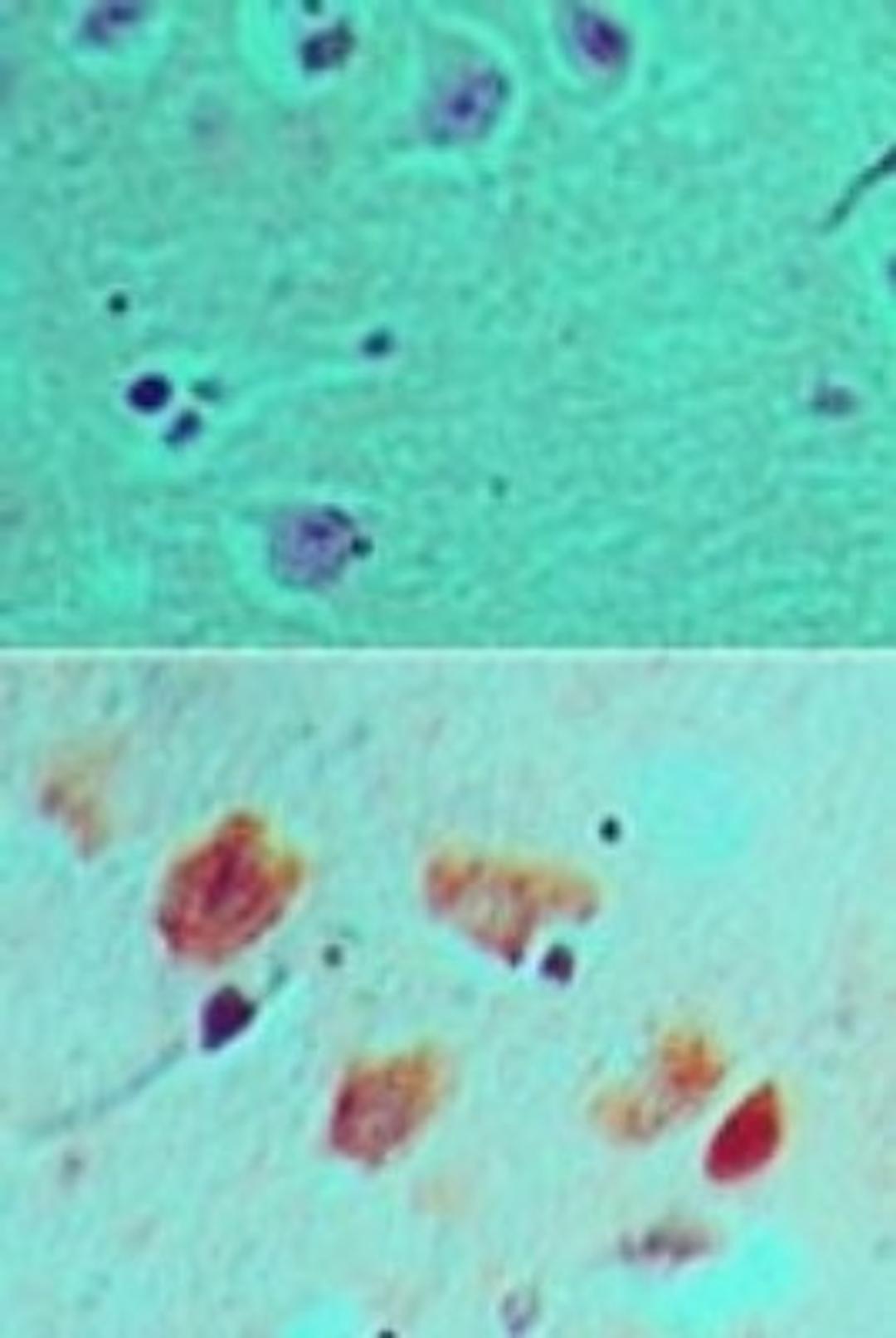 Immunohistochemistry-Paraffin: DLL3 Antibody [NBP2-24669] - Formalin-fixed, paraffin-embedded human brain tissue probed with an isotype control (top) and DLL3 antibody (bottom) at 5 ug/ml.